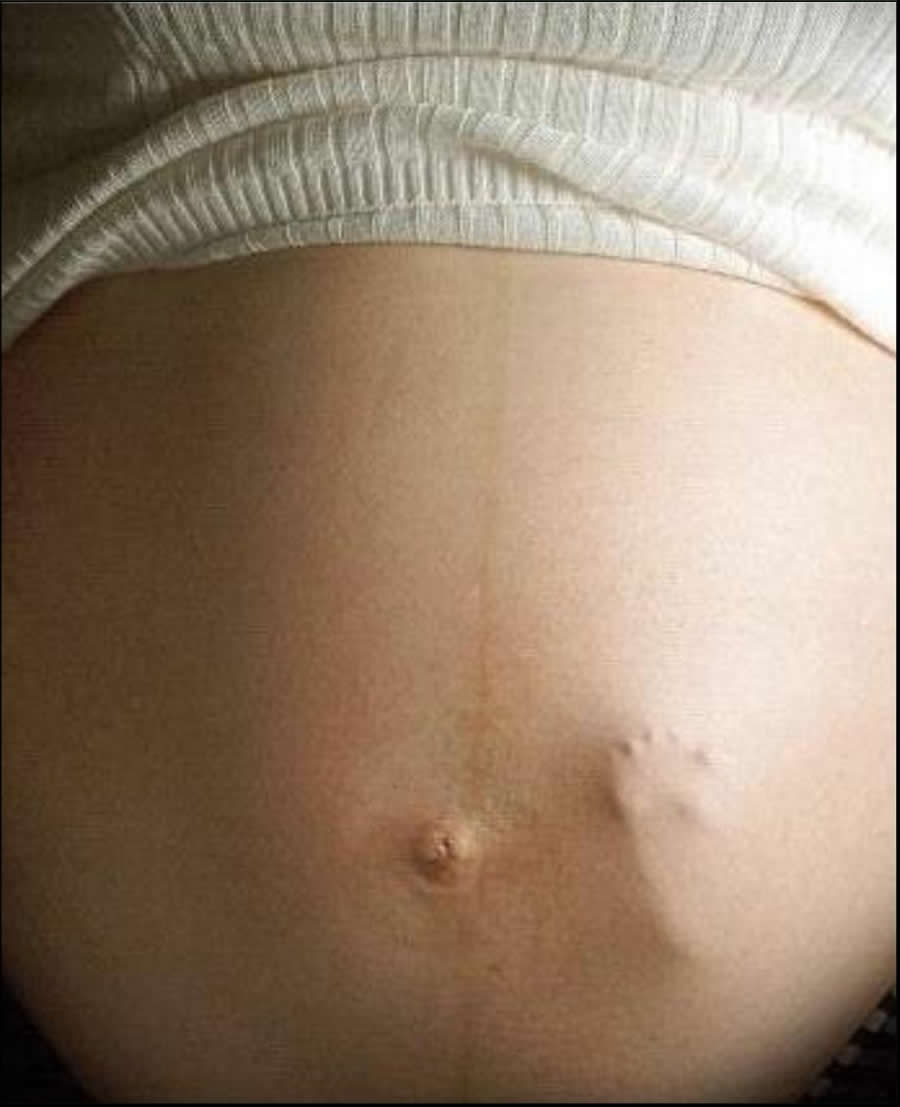 ощущения на 9 месяце беременности